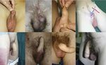 Ftm phalloplasty porn 🔥 FTM Cock - 3 Pics xHamster